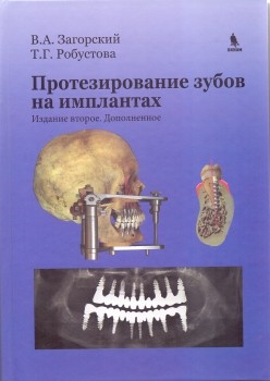 Протезирование зубов на имплантатах. 2-е изд.